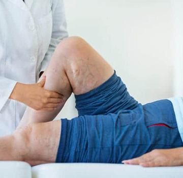 Dr. Craddock performing an in-office vein procedure at Southern Vein Care.